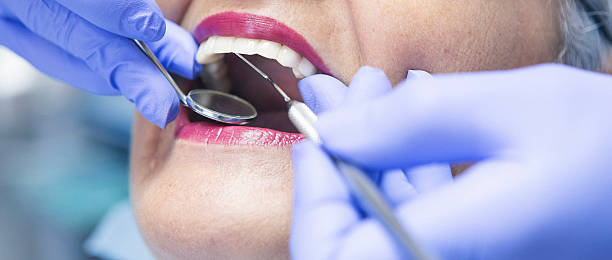 Best Emergency Root Canal Treatment in Talent, OR